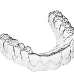 5 Lý Do Dùng  ADClearAligner khi niềng răng cần biết